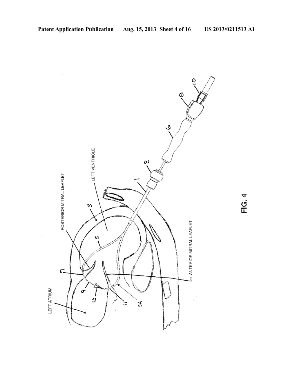 METHOD AND APPARATUS FOR REPAIRING A MITRAL VALVE - diagram, schematic, and image 05