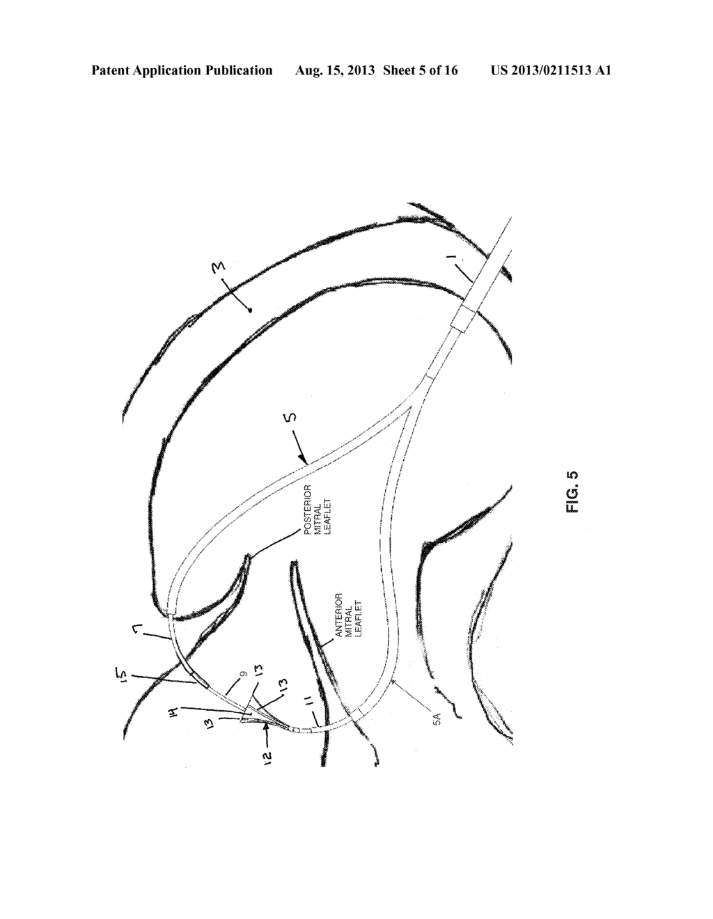 METHOD AND APPARATUS FOR REPAIRING A MITRAL VALVE - diagram, schematic, and image 06