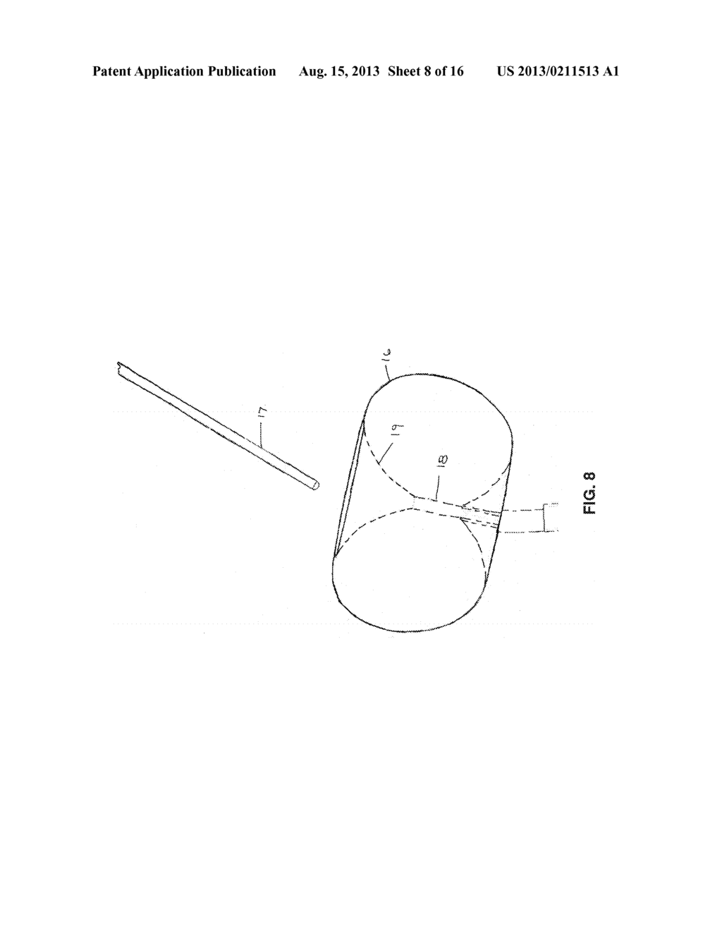 METHOD AND APPARATUS FOR REPAIRING A MITRAL VALVE - diagram, schematic, and image 09