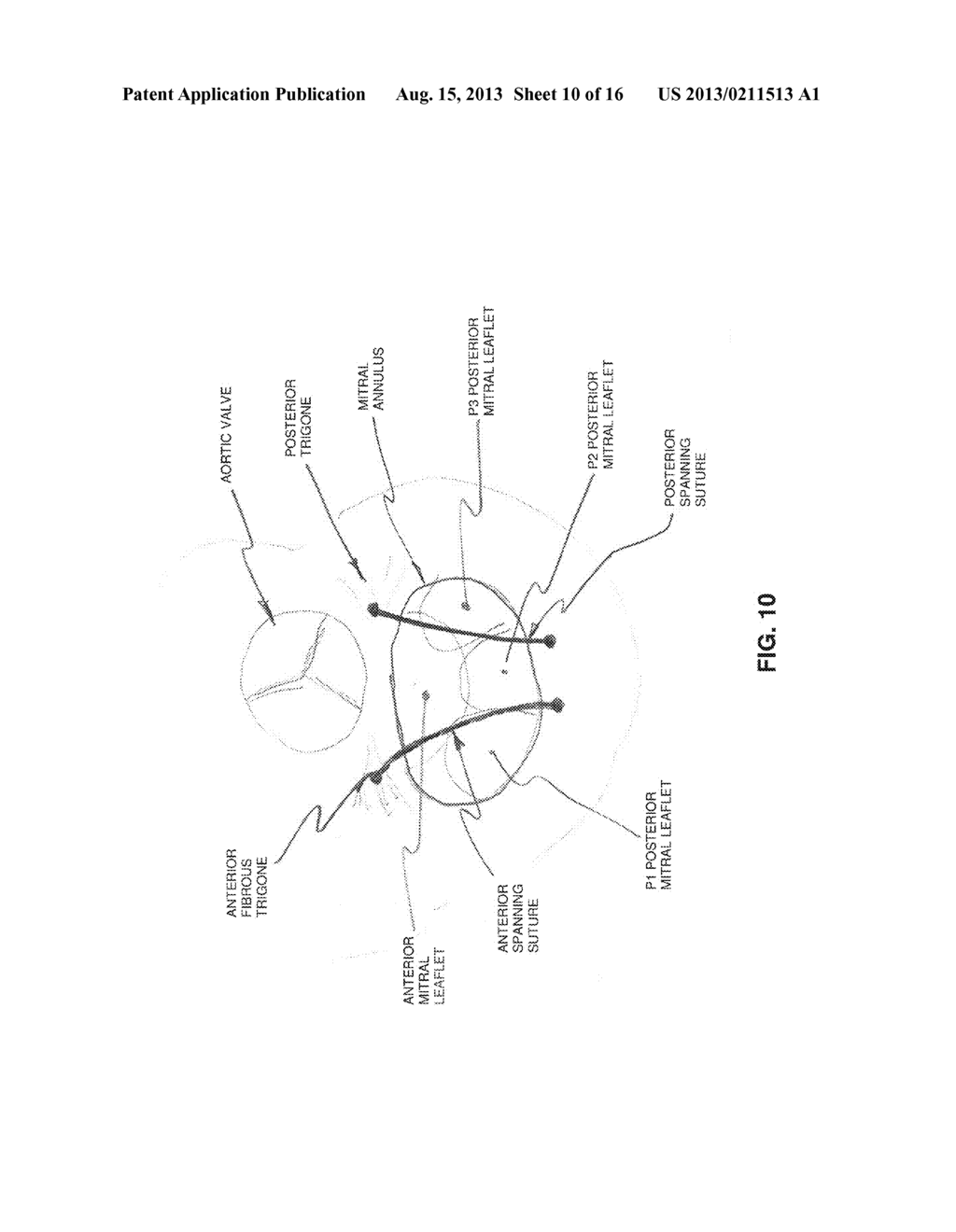 METHOD AND APPARATUS FOR REPAIRING A MITRAL VALVE - diagram, schematic, and image 11