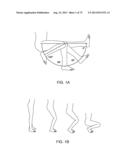 SYSTEMS AND METHODS FOR PROVIDING AN ANTERIOR FLANGE FOR A FEMORAL     COMPONENT diagram and image