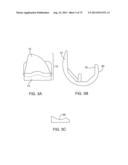 SYSTEMS AND METHODS FOR PROVIDING AN ANTERIOR FLANGE FOR A FEMORAL     COMPONENT diagram and image