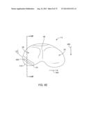 SYSTEMS AND METHODS FOR PROVIDING AN ANTERIOR FLANGE FOR A FEMORAL     COMPONENT diagram and image