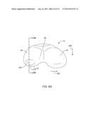 SYSTEMS AND METHODS FOR PROVIDING AN ANTERIOR FLANGE FOR A FEMORAL     COMPONENT diagram and image