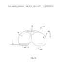 SYSTEMS AND METHODS FOR PROVIDING AN ANTERIOR FLANGE FOR A FEMORAL     COMPONENT diagram and image