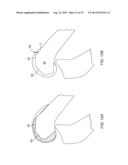 SYSTEMS AND METHODS FOR PROVIDING AN ANTERIOR FLANGE FOR A FEMORAL     COMPONENT diagram and image