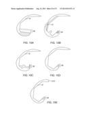 SYSTEMS AND METHODS FOR PROVIDING AN ANTERIOR FLANGE FOR A FEMORAL     COMPONENT diagram and image