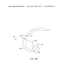 SYSTEMS AND METHODS FOR PROVIDING AN ANTERIOR FLANGE FOR A FEMORAL     COMPONENT diagram and image