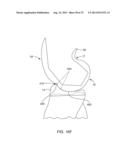 SYSTEMS AND METHODS FOR PROVIDING AN ANTERIOR FLANGE FOR A FEMORAL     COMPONENT diagram and image