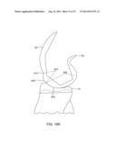 SYSTEMS AND METHODS FOR PROVIDING AN ANTERIOR FLANGE FOR A FEMORAL     COMPONENT diagram and image