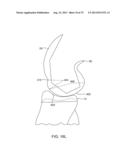 SYSTEMS AND METHODS FOR PROVIDING AN ANTERIOR FLANGE FOR A FEMORAL     COMPONENT diagram and image