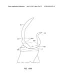 SYSTEMS AND METHODS FOR PROVIDING AN ANTERIOR FLANGE FOR A FEMORAL     COMPONENT diagram and image