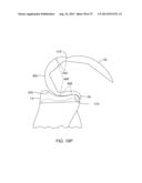 SYSTEMS AND METHODS FOR PROVIDING AN ANTERIOR FLANGE FOR A FEMORAL     COMPONENT diagram and image