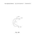 SYSTEMS AND METHODS FOR PROVIDING AN ANTERIOR FLANGE FOR A FEMORAL     COMPONENT diagram and image