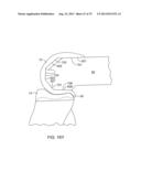 SYSTEMS AND METHODS FOR PROVIDING AN ANTERIOR FLANGE FOR A FEMORAL     COMPONENT diagram and image