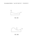 SYSTEMS AND METHODS FOR PROVIDING AN ANTERIOR FLANGE FOR A FEMORAL     COMPONENT diagram and image