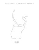 SYSTEMS AND METHODS FOR PROVIDING AN ANTERIOR FLANGE FOR A FEMORAL     COMPONENT diagram and image