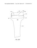 SYSTEMS AND METHODS FOR PROVIDING AN ANTERIOR FLANGE FOR A FEMORAL     COMPONENT diagram and image