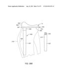 SYSTEMS AND METHODS FOR PROVIDING AN ANTERIOR FLANGE FOR A FEMORAL     COMPONENT diagram and image