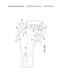 SYSTEMS AND METHODS FOR PROVIDING AN ANTERIOR FLANGE FOR A FEMORAL     COMPONENT diagram and image