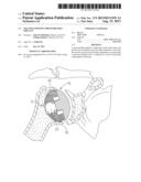 NEGATIVE-POSITIVE PRESSURIZABLE IMPLANT diagram and image