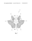 NEGATIVE-POSITIVE PRESSURIZABLE IMPLANT diagram and image