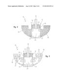 NEGATIVE-POSITIVE PRESSURIZABLE IMPLANT diagram and image