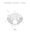 NEGATIVE-POSITIVE PRESSURIZABLE IMPLANT diagram and image