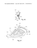 CUSHION TO FRAME ASSEMBLY MECHANISM diagram and image