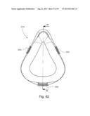 CUSHION TO FRAME ASSEMBLY MECHANISM diagram and image