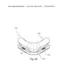 CUSHION TO FRAME ASSEMBLY MECHANISM diagram and image