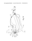 CUSHION TO FRAME ASSEMBLY MECHANISM diagram and image