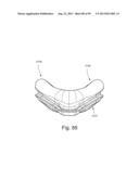 CUSHION TO FRAME ASSEMBLY MECHANISM diagram and image