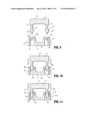 Surgical Fastening Apparatus diagram and image