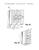 VARIABLE ANGLE MULTI-POINT INJECTION diagram and image