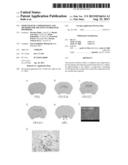 IMMUNOGENIC COMPOSITIONS AND METHODS FOR TREATING NUEROLOGIC DISORDERS diagram and image