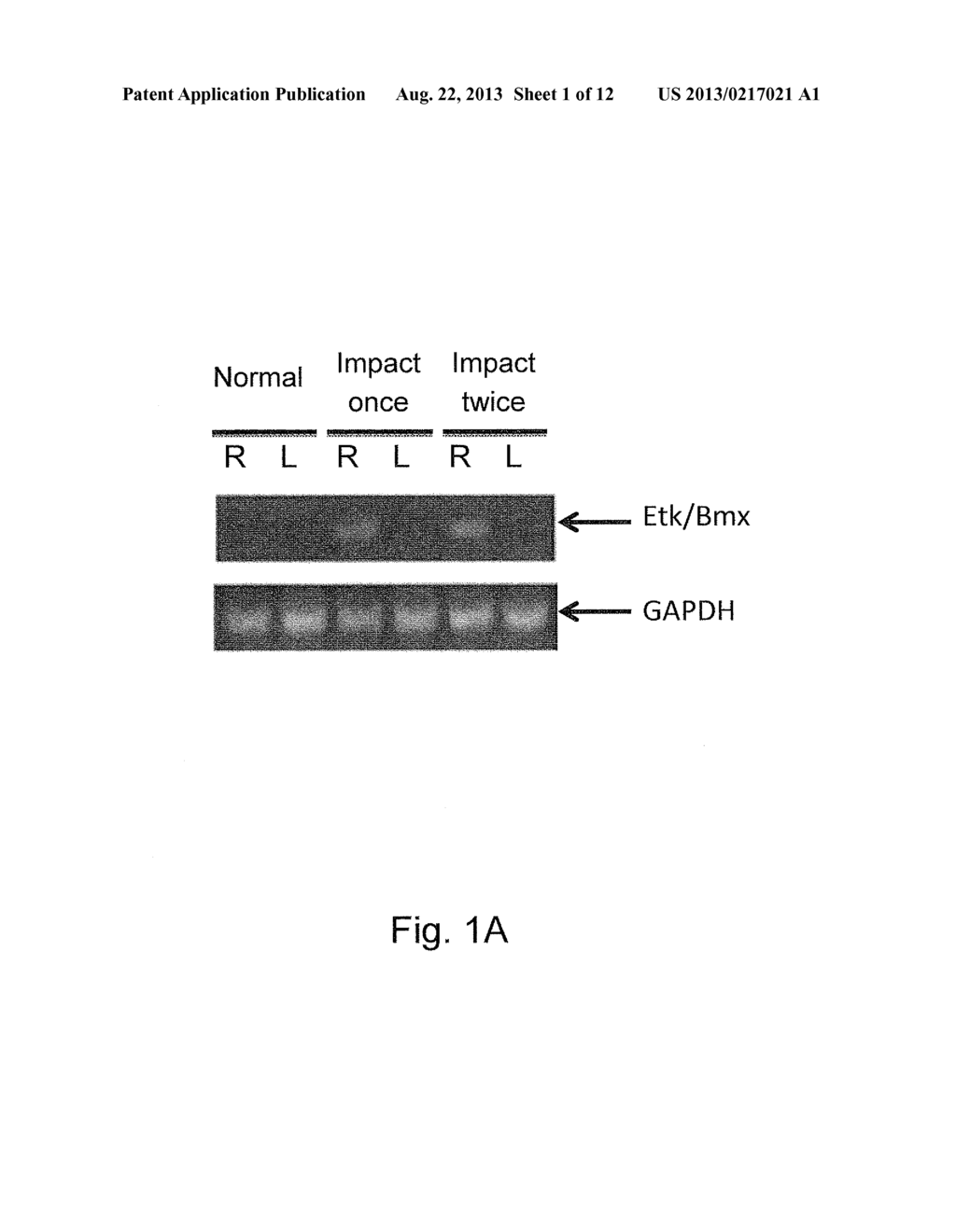 METHOD FOR DETECTING AND EXAMINING TRAUMATIC BRAIN INJURY IN VITRO - diagram, schematic, and image 02