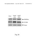 METHOD FOR DETECTING AND EXAMINING TRAUMATIC BRAIN INJURY IN VITRO diagram and image