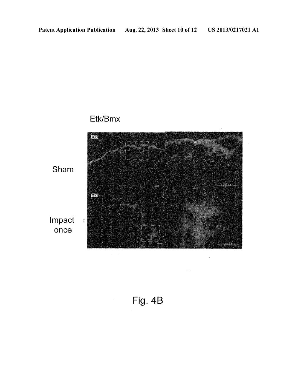 METHOD FOR DETECTING AND EXAMINING TRAUMATIC BRAIN INJURY IN VITRO - diagram, schematic, and image 11