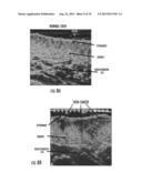 Hybrid Ultrasound-Guided Superficial Radiotherapy System and Method diagram and image