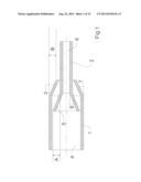 Male Telescope Catheter diagram and image