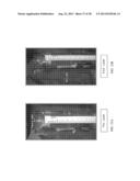 Endovenous Laser Treatment Generating Reduced Blood Coagulation diagram and image