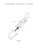 DEVICE FOR DEPLOYING A FLEXIBLE IMPLANT diagram and image