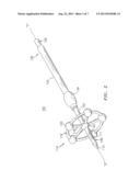 METHOD AND APPARATUS FOR RADICAL PROSTATECTOMY ANASTOMOSIS diagram and image