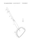 METHOD AND APPARATUS FOR RADICAL PROSTATECTOMY ANASTOMOSIS diagram and image