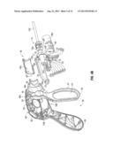 Knife Deployment Mechanisms for Surgical Forceps diagram and image