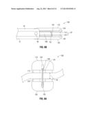 Knife Deployment Mechanisms for Surgical Forceps diagram and image