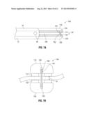 Knife Deployment Mechanisms for Surgical Forceps diagram and image