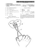 TISSUE APPROXIMATION DEVICE diagram and image