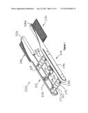 TISSUE APPROXIMATION DEVICE diagram and image